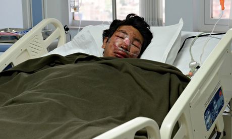 Один из выживших шерп в лавине 18 апреля 2014 года. Фото из больницы Катманду