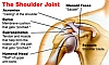 Синдром повреждения плеча у скалолазов и его лечение