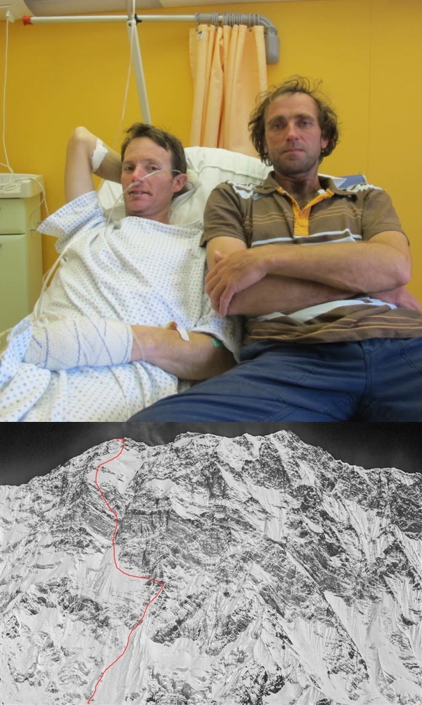 Стефан Бенуа (Stephane Benoist) и Янник Гразиани (Yannick Graziani) в больнице, после восхождения на Аннапурну