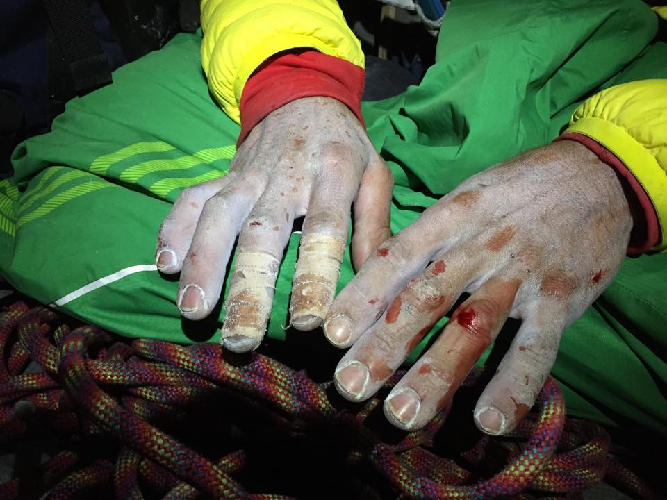 Пальцы Кевина Йоргенсона при прохождении 15-ой веревки