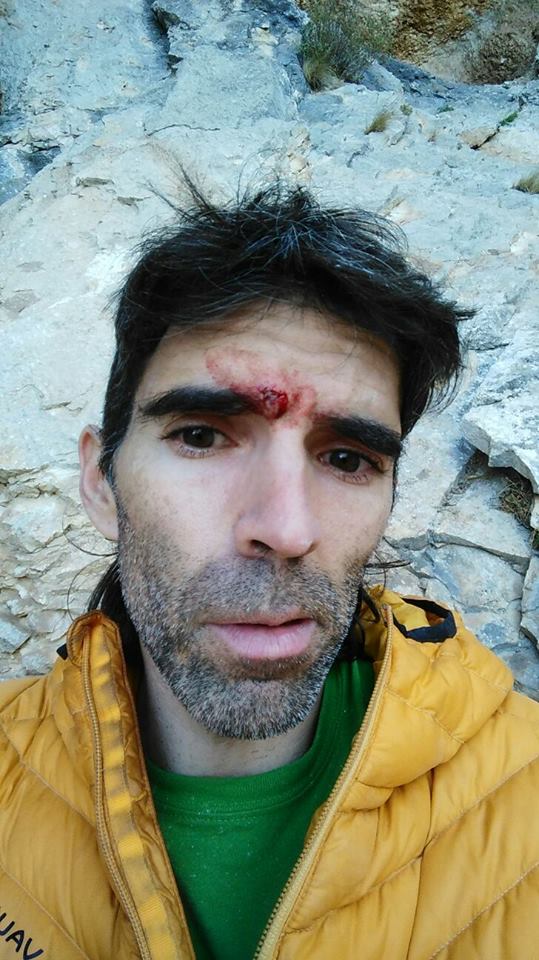 Дани Андрада (Dani Andrada) после травмы на маршруте "Chilam Balam"