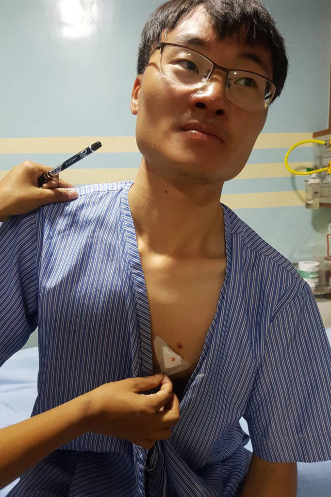 китайский альпинист Пенг Тао (Peng Tao) получил серьёзные травмы в области грудной клетки и был доставлен в больницу в Катманду. Фото Rajan Pokhrel