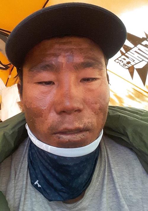 Нима Шеринг Шерпа (Nima Tshering Sherpa) после спасработ на Аннапурне