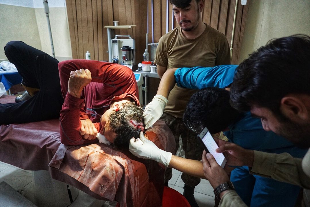 Алистер Джеймс Суинтон (Alastair James Swinton) в больнице в Пакистане после аварии на Койо-Зом  (Koyo Zum, 6872 метра). Фото Tom Livingstone