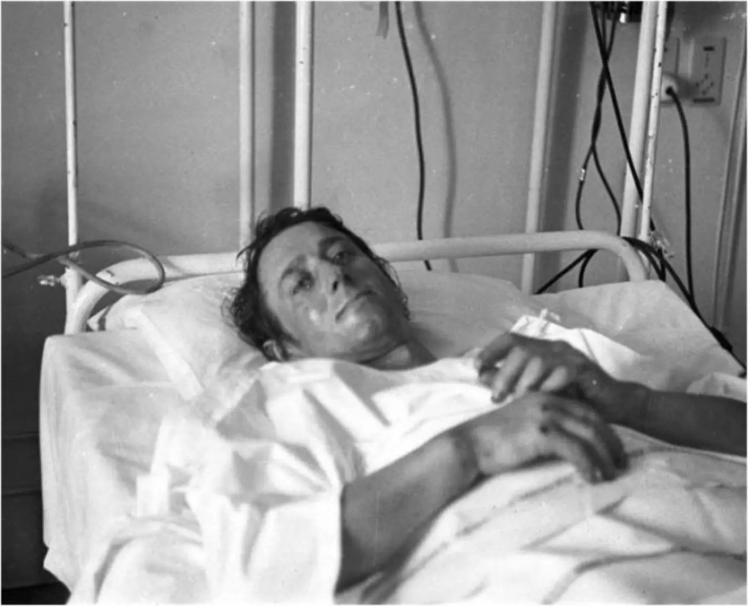 Роне Демезон (Rene Desmaison) у лікарні після порятунку. Фото: з блогу Джонатана Гріффіта «Alpine Exposures»