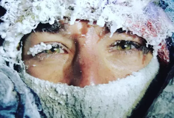 Елізабет Рівол, врятована із зимового сходження на восьмитисяник Нангапарбат, та постраждала від сильного обмороження рук і лівої стопи; проте їй вдалося уникнути ампутації. Фото: Elisabeth Revol